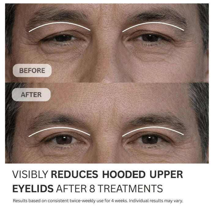 Multi - Peptide Micro - Infusion System 2.0 for Hooded Eyes - PDRN + GHK - Cu + NAD⁺ - Botanique Paris