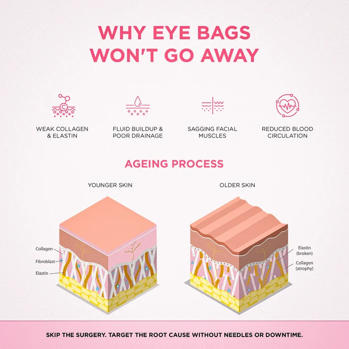 RevitalEyes® 2 - in - 1 Red Light Therapy + EMS To Erase Eye Bags - Botanique Paris